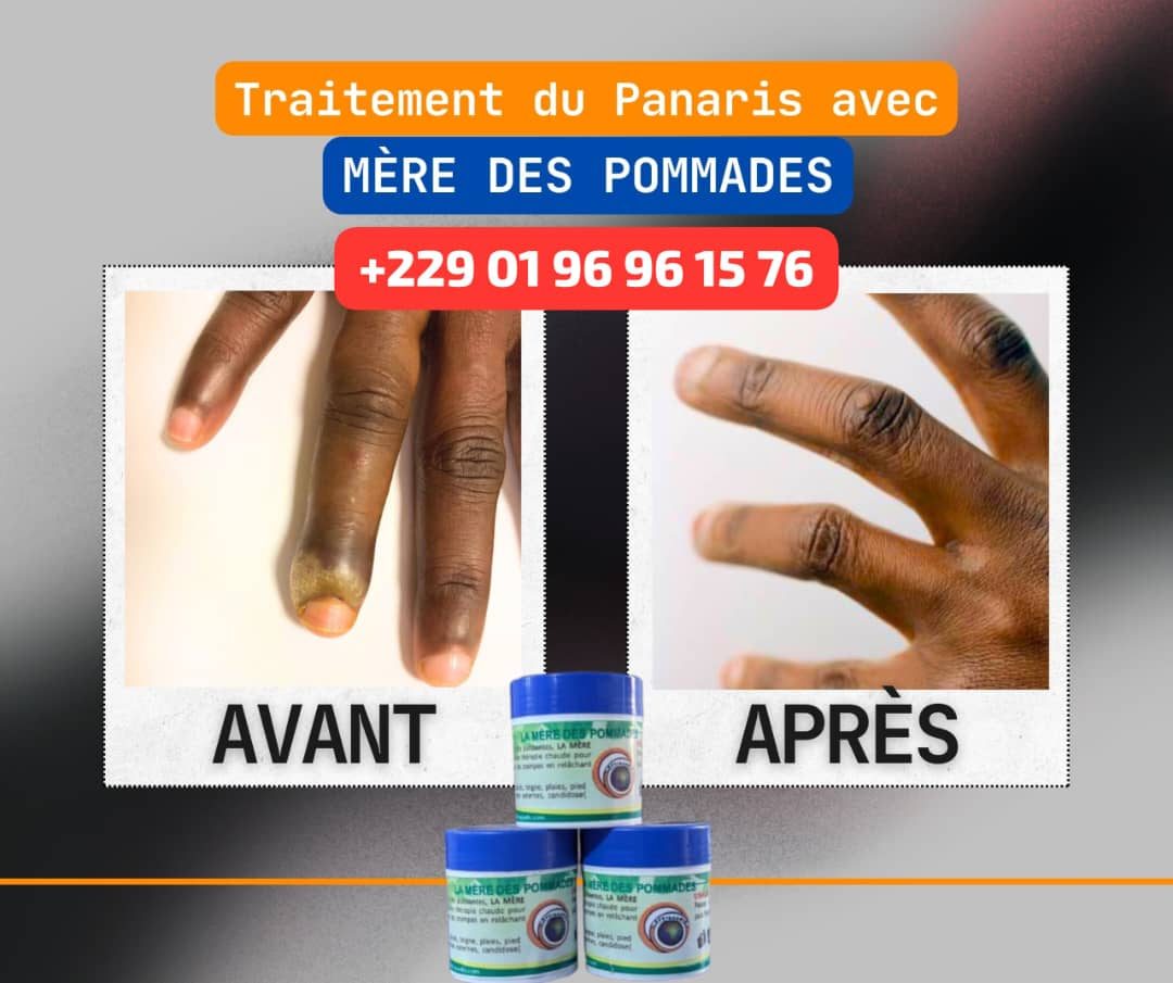 La Mère Des Pommades